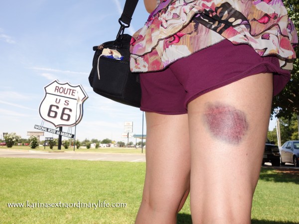 The clumsy Canadian in her short-shorts, showing off her new 7 month long temporary purple tattoo. Ouch! El Reno, Oklahoma, USA – Karina Noriega